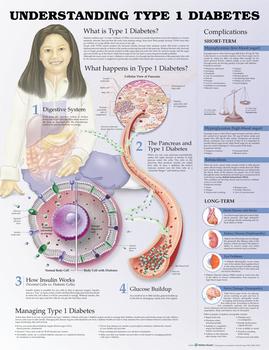 Understanding Type 1 Diabetes Chart