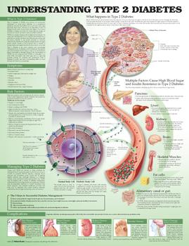 Understanding Type 2 Diabetes Chart