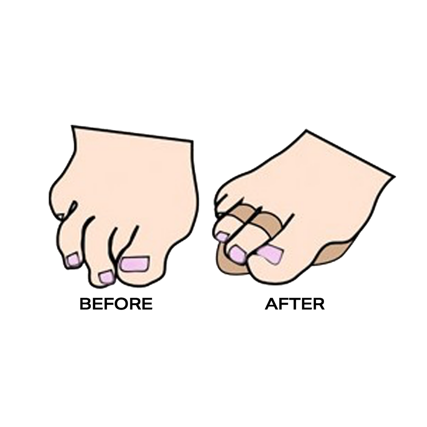 Dr. Jill's Budin Splint