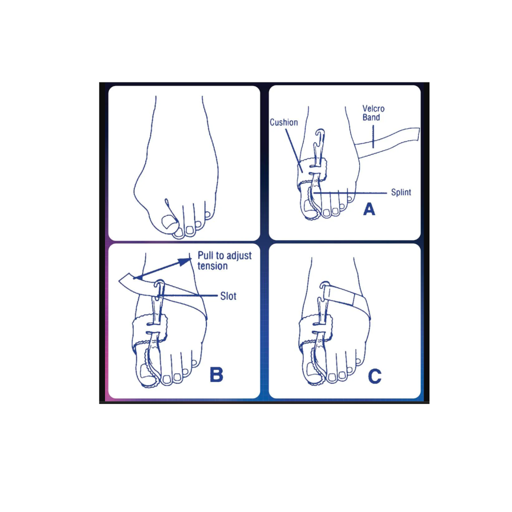 Pedifix Nighttime Bunion Regulator™ (1/Pkg)