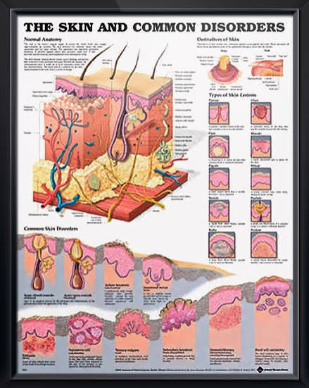 Common Lesions and Disorders of the Skin Anatomical Chart