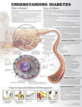 Understanding Diabetes Chart