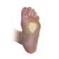 Dr. Jill's 1/4" Metatarsal Pads (J-10 Firm Felt Skived)
